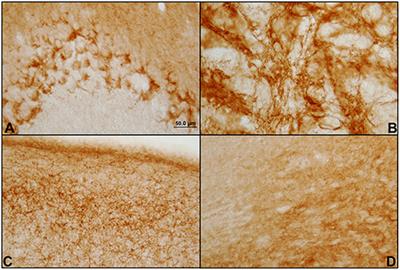 Distribution of the Cannabinoid Receptor Type 1 in the Brain of the Genetically Audiogenic Seizure-Prone Hamster GASH/Sal